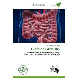    Giant cell Arteritis (9786200686978) Evander Luther Books