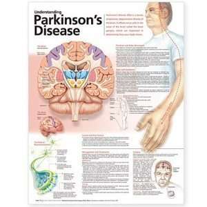   Parkinsonâ?TMs Disease Chart/Poster