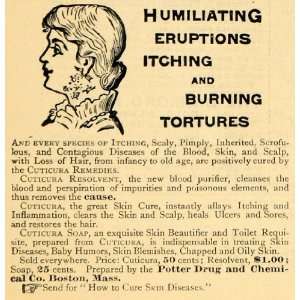 1885 Ad Potter Drug Chemical Cuticura Cures Itch Burn 