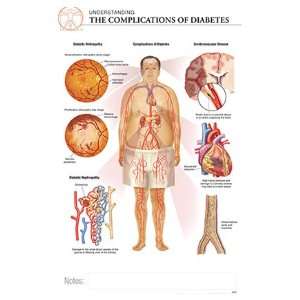   17 Post It Disease Chart COMPLICATIONS OF DIABETES 